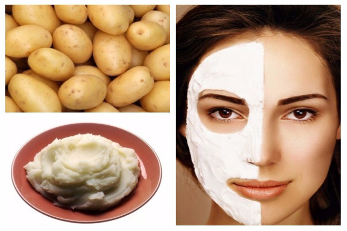 Potato Potato Benefits For Skin : पिंपल्स के निशान मिटाने से लेकर झाइयां हटाने तक में फायदेमंद है आलू