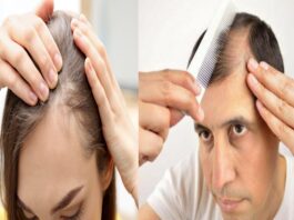 best hair fall control oil in IndiaMuditam Onion Oil