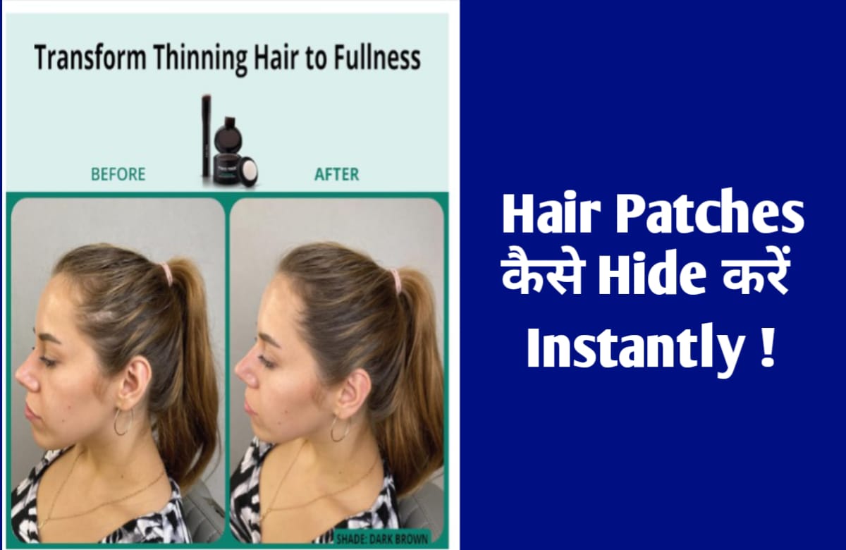 Hair Patches : Instantly कैसे hide करें